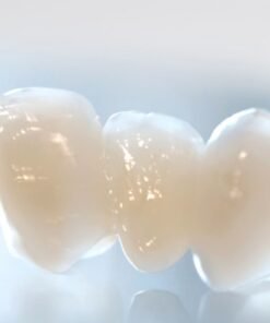 MẶT DÁN SỨ VENEER